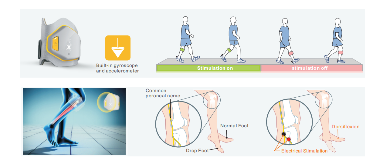 NMES Parameters for Foot Drop